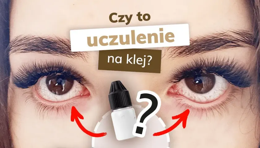 Alergia na klej do rzęs: Objawy, leczenie i co robić krok po kroku